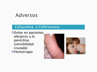 Cefazolina y Ceftriaxona
Evitar en pacientes
 alérgicos a la
 penicilina
 (sensibilidad
 cruzada)
Hemorragia
 
