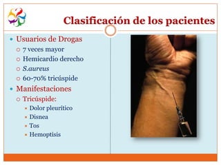 Clasificación de los pacientes
 Usuarios de Drogas
    7 veces mayor
    Hemicardio derecho
    S.aureus
    60-70% tricúspide
 Manifestaciones
    Tricúspide:
      Dolor pleurítico
      Disnea
      Tos
      Hemoptisis
 