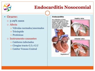Endocarditis Nosocomial

 Ocurre:
   5-29% casos

   Afecta
         Válvulas normales/anormales
         Tricúspide
         Protésicas
     Instrumento causantes
         Catéteres infectados
         Cirugías tracto G.I y G.U
         Catéter Venoso Central
 