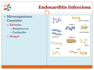 Endocarditis Infecciosa

 Microorganismos
 Causantes:
    Bacterias
      Streptococcos
      Cocobacilos

    Hongos
 
