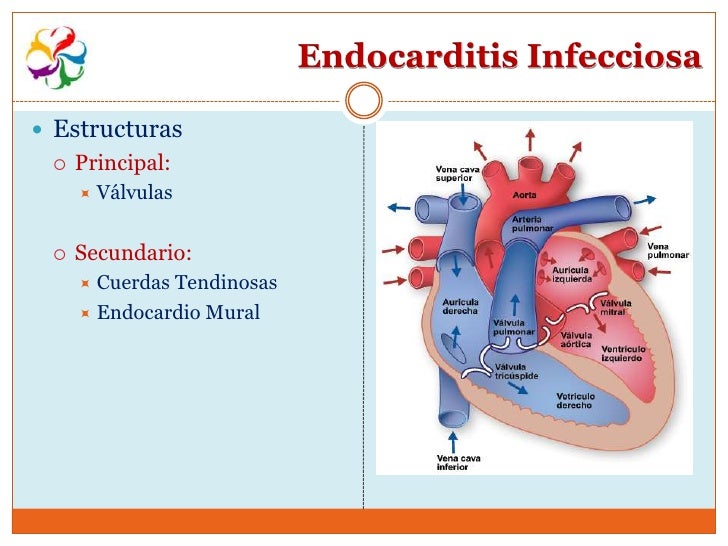 Endocarditis
