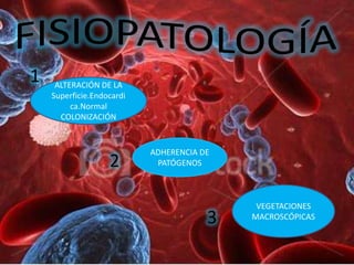 1    ALTERACIÓN DE LA
    Superficie.Endocardi
         ca.Normal
      COLONIZACIÓN



                           ADHERENCIA DE
                   2        PATÓGENOS



                                            VEGETACIONES
                                       3   MACROSCÓPICAS
 