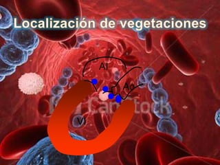 AI

          Ao


VI
 