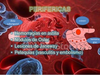 Área      pulpejos
subungueal




                        hemorra
                          gias
 