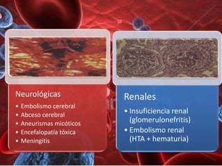 Neurológicas               Renales
•   Embolismo cerebral
•   Abceso cerebral
                           • Insuficiencia renal
•   Aneurismas micóticos
                             (glomerulonefritis)
•   Encefalopatía tóxica   • Embolismo renal
•   Meningitis               (HTA + hematuria)
 