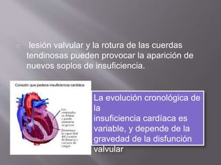 lesión valvular y la rotura de las cuerdas
tendinosas pueden provocar la aparición de
nuevos soplos de insuficiencia.
La evolución cronológica de
la
insuficiencia cardíaca es
variable, y depende de la
gravedad de la disfunción
valvular
 