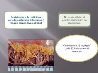 Resistentes a la meticilina
válvulas naturales infectadas (
ningún dispositivo extraño)
No es de utilidad el
empleo sistemático de
rifampicina.
Vancomicina 15 mg/kg IV
cada 12 h durante 4-6
semanas
 