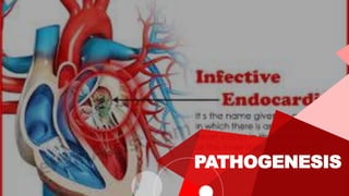 Endocarditis Animation Infective Endocarditis | PPTX