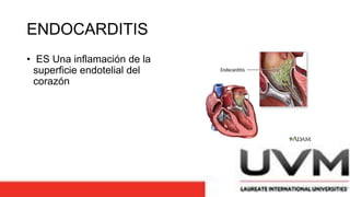 ENDOCARDITIS
• ES Una inflamación de la
superficie endotelial del
corazón
 
