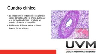 Cuadro clínico
• La infección del endotelio de los grandes
vasos como la aorta , la arteria pulmonar
y el conducto arterioso , produce un
cuadro clínico de endarteritis .
• Endarteritis: Inflamación de la túnica
interna de las arterias.
 