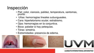Inspección
• Piel: color, cianosis, palidez, temperatura, xantomas,
prurito .
• Uñas: hemorragias lineales subungueales.
• Cara: hipertelorismo ocular, estrabismo.
• Ojos: hemorragias en la conjuntiva.
• Boca: paladar si hay petequias.
• Tórax: simetría.
• Extremidades: presencia de edema.
 
