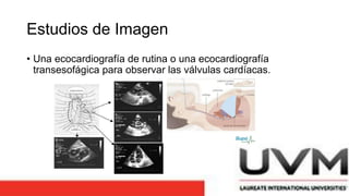 Estudios de Imagen
• Una ecocardiografía de rutina o una ecocardiografía
transesofágica para observar las válvulas cardíacas.
 