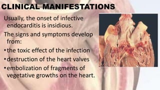 CLINICAL MANIFESTATIONS
Usually, the onset of infective
endocarditis is insidious.
The signs and symptoms develop
from:
•the toxic effect of the infection
•destruction of the heart valves
•embolization of fragments of
vegetative growths on the heart.
 