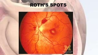 ROTH’S SPOTS
 