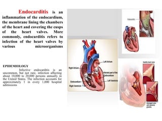Endocarditis is an
inflammation of the endocardium,
the membrane lining the chambers
of the heart and covering the cusps
of the heart valves. More
commonly, endocarditis refers to
infection of the heart valves by
various microorganisms
EPIDEMIOLOGY
Infective endocarditis is an
uncommon, but not rare, infection affecting
about 10,000 to 20,000 persons annually in
the United States. The infection accounts for
approximately 1 in every 1,000 hospital
admissions
 