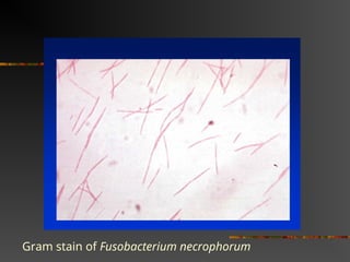 Gram stain of Fusobacterium necrophorum
 