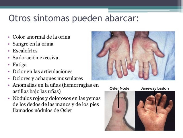 La crema del cansancio de los pies y las venas en los pies