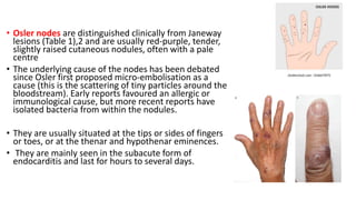Endocarditis (1).pptx