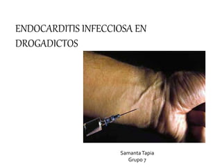 ENDOCARDITIS INFECCIOSA EN
DROGADICTOS
SamantaTapia
Grupo 7
 