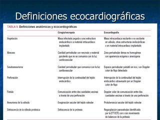 Definiciones ecocardiográficas
 