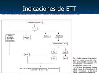 Indicaciones de ETT
 