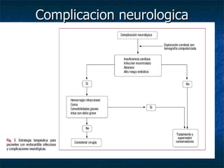 Complicacion neurologica
 