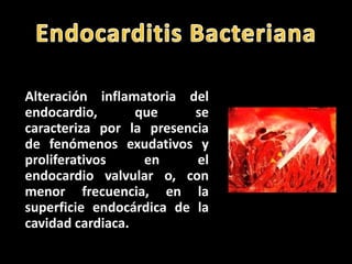 Alteración inflamatoria del
endocardio, que se
caracteriza por la presencia
de fenómenos exudativos y
proliferativos en el
endocardio valvular o, con
menor frecuencia, en la
superficie endocárdica de la
cavidad cardiaca.
 