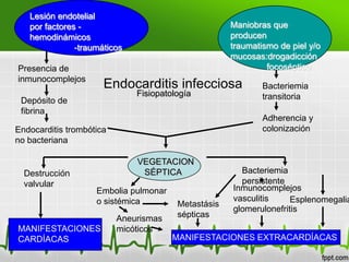 Lesión endotelial
   por factores -                                    Maniobras que
   hemodinámicos                                     producen
               -traumáticos                          traumatismo de piel y/o
                                                     mucosas:drogadicción
Presencia de                                                  focoséptico
inmunocomplejos
                      Endocarditis infecciosa                Bacteriemia
                              Fisiopatología                 transitoria
 Depósito de
 fibrina
                                                             Adherencia y
Endocarditis trombótica                                      colonización
no bacteriana

                              VEGETACION
  Destrucción                  SÉPTICA                 Bacteriemia
  valvular                                             persistente
                    Embolia pulmonar                 Inmunocomplejos
                    o sistémica                      vasculitis     Esplenomegalia
                                        Metastásis
                                                     glomerulonefritis
                          Aneurismas    sépticas
MANIFESTACIONES           micóticos
CARDÍACAS                              MANIFESTACIONES EXTRACARDÍACAS
 