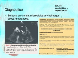 Diagnóstico
• Se basa en clínica, microbiología y hallazgos
ecocardiográficos.
80% de
sensibilidad y
especificidad
 