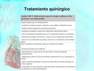Tratamiento quirúrgico
 