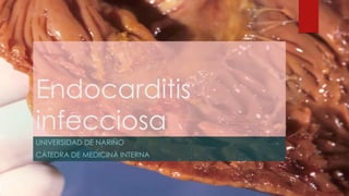 Endocarditis
infecciosa
UNIVERSIDAD DE NARIÑO
CÁTEDRA DE MEDICINA INTERNA

 