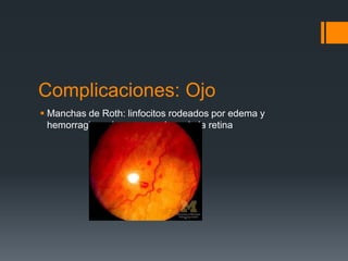 Complicaciones: Ojo
 Manchas de Roth: linfocitos rodeados por edema y
hemorragia en la capa nerviosa de la retina
 
