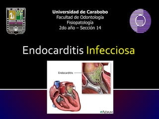 Endocarditis Infecciosa
Universidad de Carabobo
Facultad de Odontología
Fisiopatología
2do año – Sección 14
 