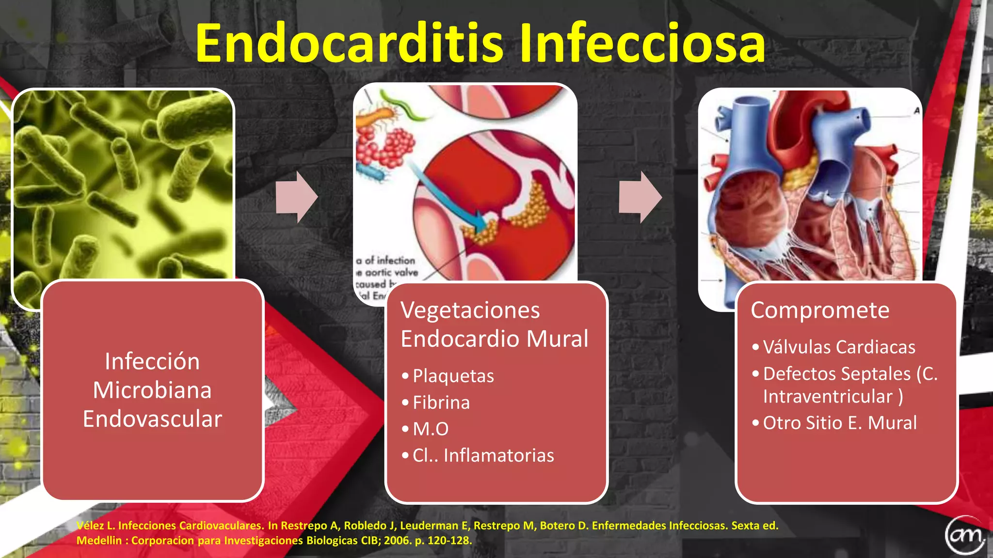 Endocarditis T Endocarditis infecciosa | PPTX