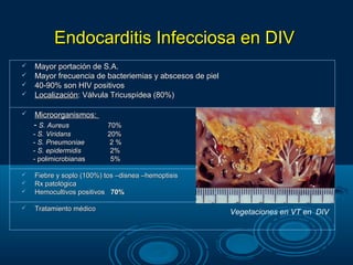 Endocarditis Infecciosa en DIV
   Mayor portación de S.A.
   Mayor frecuencia de bacteriemias y abscesos de piel
   40-90% son HIV positivos
   Localización: Válvula Tricuspídea (80%)

   Microorganismos:
    - S. Aureus           70%
    - S. Viridans         20%
    - S. Pneumoniae        2%
    - S. epidermidis       2%
    - polimicrobianas      5%

   Fiebre y soplo (100%) tos –disnea –hemoptisis
   Rx patológica
   Hemocultivos positivos 70%

   Tratamiento médico
                                                          Vegetaciones en VT en DIV
 