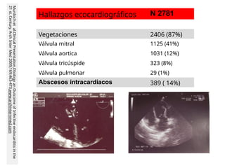 Hallazgos ecocardiográficos N 2781
Vegetaciones 2406 (87%)
Válvula mitral 1125 (41%)
Válvula aortica 1031 (12%)
Válvula tricúspide 323 (8%)
Válvula pulmonar 29 (1%)
Abscesos intracardiacos 389 ( 14%)
Murdoch
et
al.Clinical
Presentation,Etiology
an
Outcome
of
Infective
endocarditis
in
the
21
st.
Century.
Arch
Inter
Med
2009;169:463-473.www.archinternmed.com
 