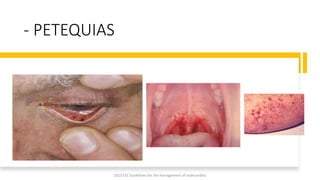 - PETEQUIAS
2023 ESC Guidelines for the management of endocarditis
 