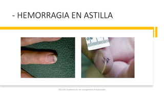 - HEMORRAGIA EN ASTILLA
2023 ESC Guidelines for the management of endocarditis
 