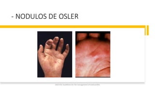 - NODULOS DE OSLER
2023 ESC Guidelines for the management of endocarditis
 