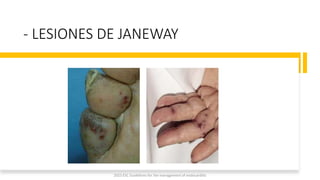 - LESIONES DE JANEWAY
2023 ESC Guidelines for the management of endocarditis
 