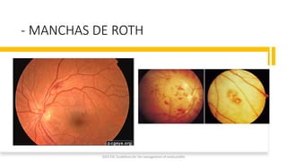 - MANCHAS DE ROTH
2023 ESC Guidelines for the management of endocarditis
 