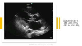 ECOCARDIOGRAFIA
- ETT: S 75% E 99%
- ETE: S > 90% E 99%
2023 ESC Guidelines for the management of endocarditis
 