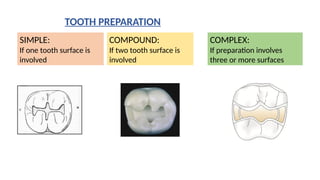 Tooth Compound ENDO(Cavity preparations formmmmmmmmmmmmmmmmmm) (1).pptx