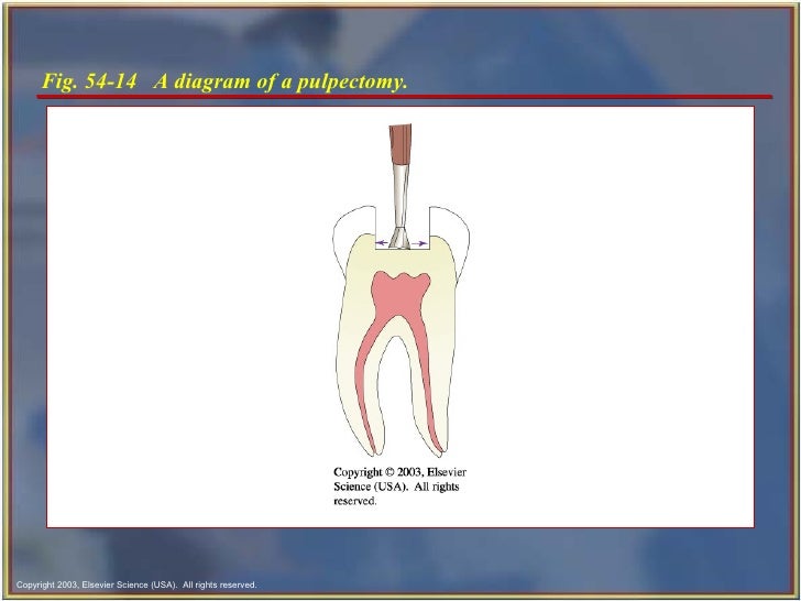 Endodontics Chapter 54