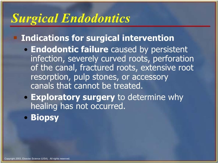 Endodontics Chapter 54