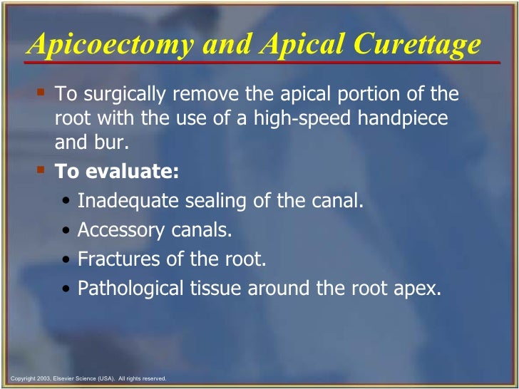 Endodontics Chapter 54