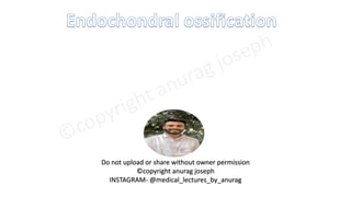 Do not upload or share without owner permission
©copyright anurag joseph
INSTAGRAM- @medical_lectures_by_anurag
 