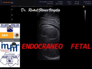 ENDOCRANEO FETAL 
Dr. Romel Flores Virgilio  