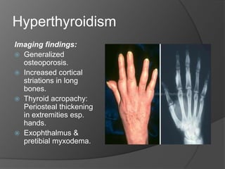 Endocrinal and metabolic disorders | PPTX