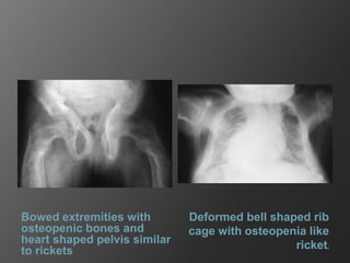 Endocrinal and metabolic disorders | PPTX